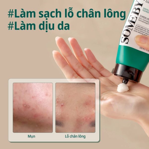 làm sạch lỗ chân lông Some By Mi Aha-Bha-Pha 30 Days Miracle Acne Clear Foam