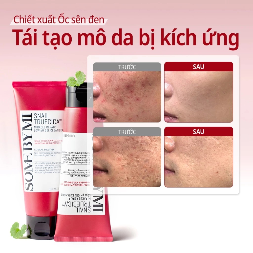 sữa rửa mặt ốc sên Snail Truecica Miracle Repair Low pH Gel Cleanser sữa rửa mặt ốc sên Snail Truecica Miracle Repair Low pH Gel Cleanser