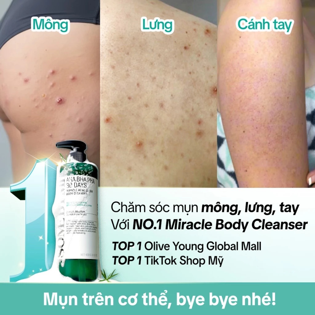 sữa tắm trị mụn toàn thân Some By Mi sữa tắm trị mụn toàn thân Some By Mi
